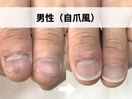 男性(自爪風)