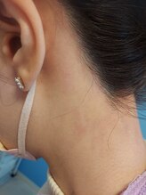 キアラ 麻布十番(Kiara)/うなじ脱毛 えりあし脱毛