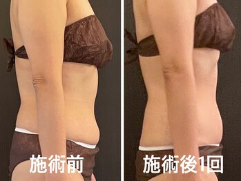 ルーシーガーデン(LUCY GARDEN)/下腹・背中肉!重点的◎/50代