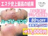 【85%OFF!!50,000円→11,000円】ニキビケア/毛穴/肌改善ハーブピーリングFCR