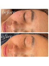 ラディエンス 多治見店/マーメイドセルトリートメント