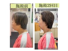 新リンパサロン 大阪の雰囲気（最先端の道具と手技でむくみがスッキリ）