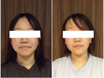 美容整体ウェリナ あま甚目寺院/小顔矯正/骨盤矯正/美脚サロン