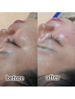 ビーマジック(Be Magic)/年末のお肌の大掃除!