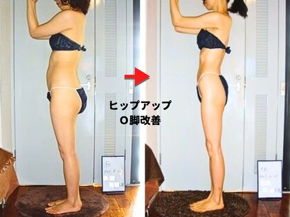 痩身 セル脂肪専門 スタイルデザインの写真