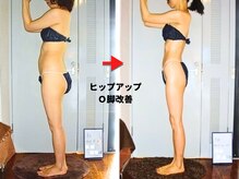 痩身 セル脂肪専門 スタイルデザイン
