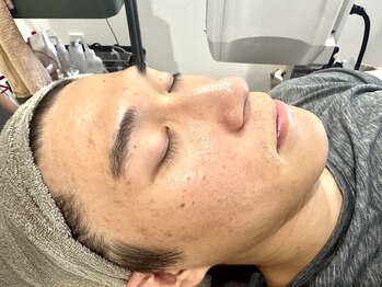 ルミエール 札幌大通parkside店の写真/毛穴の目立ち＆黒ずみ改善！洗顔だけでは落ちない古い角質をケアし、清潔感あふれる健康的な肌へ