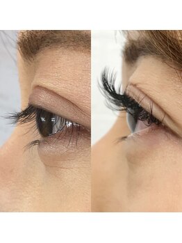 ローズ(ROSE)/アップワードラッシュ