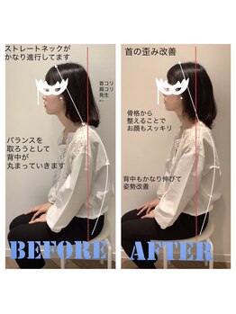 ビュースタイル川西/猫背解消!