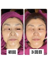 ビューティーサロン キャンディ 海老名(Candy)/