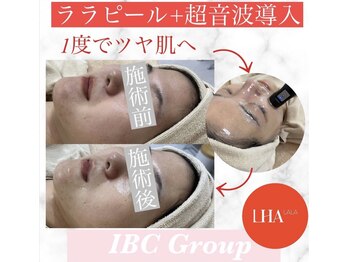 IBC 上大岡店/話題のララピール！