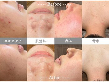 アマリリス(Amaryllis)