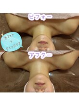 クレマチス/光フォト＋クイックケア