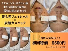 ノノキレイラボ(NONOKIREI LAB)の雰囲気（光フェイシャルでトーンアップ×炭酸ガスパックで小顔・毛穴に♪）