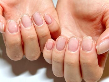 ワイドット(y.)の写真/【自爪育成◎】爪が薄い/割れやすい/形が気になるとお悩みの方にオススメ☆自爪ケアが周りと差をつける♪