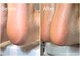 ホーム 中目黒(HOME)の写真/≪踵が乾燥している方にオススメ≫ガサガサ/フットの甘皮処理/脚のむくみや疲れ改善/魅せたくなる足へ♪