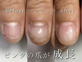 リリー/爪の面積1.5倍へ！！！