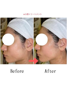 グラシア(gracia)/シミ・毛穴ケア専門店gracia