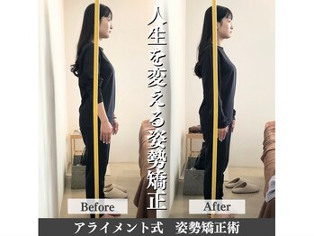 アライメントトウキョウ 恵比寿(Alignment TOKYO)/姿勢矯正(猫背・巻き肩)