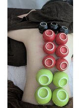 リデザイン 京都(REDESIGN)/中医カッピング療法