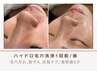 【7月限定★毛穴・黒ずみ徹底洗浄】韓国式毛穴洗浄×水分爆弾肌管理付14800→
