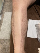 ビューティーサロン アンジュ(Ange)/両脚ワックス脱毛