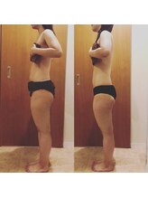 ヴィエーゾ(VIESO)/1回でお腹がぺったんこ♪