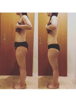 ヴィエーゾ(VIESO)/1回でお腹がぺったんこ♪