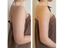 オードリリー(eau de Lily)/二の腕ほっそり