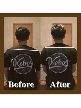 ストック(Stock)/ビフォーアフター