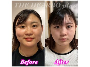 ハーボプラス(THE HEARBO plus)