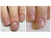 ローネイル(Raw nail)の雰囲気（メンズネイル噛み癖矯正）