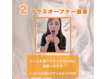 ホワイトニングショップ 銀座7丁目店(WHITENING SHOP)/【照射の流れ】2