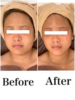 スペチアーレ 夙川/驚きの小顔効果