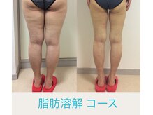 Hb 与野の雰囲気（当サロンのベテランエステティシャンの技が自慢）