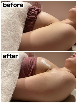 マイントゥー(mine too)/