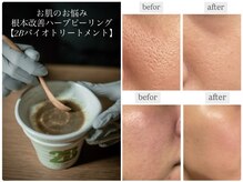 シャムリー 並木坂(Syamry)/結果を出すお肌悩み改善ハーブ