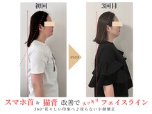 エソア(esoa)/小顔矯正×光フォト