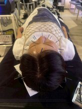 ビーワイ鍼灸整骨院 心斎橋院/美肌＆リフトアップ