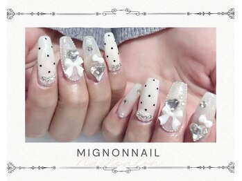ミニョンネイル(mignon nail)