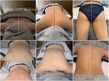 レアリゼ(REALISER)