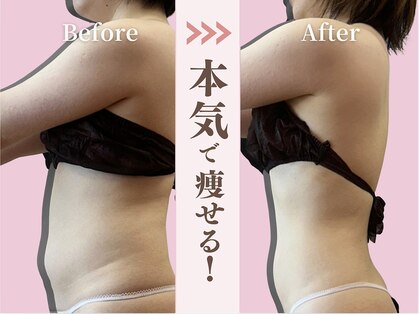 美容整体カラダリメイク(karada)の写真