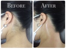 スリール 渋谷店(Sourire)/脱毛は圧倒的な回数で終わります