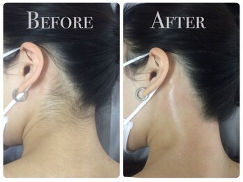 スリール 渋谷店(Sourire)/脱毛は圧倒的な回数で終わります