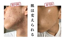 アップデートサロン(UPDATE SALON)