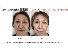 ノエル(Noel)の雰囲気(小じわやほうれい線・ハリ不足が気になる方へ◎最新LEDにお任せ)
