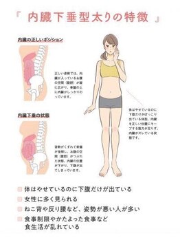 藤が丘名倉堂鍼灸接骨院/ぽっこりお腹