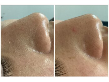 アイズ 横浜店(ize)/