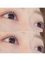 コア(Koa) パリジェンヌリフトのbeforeafter