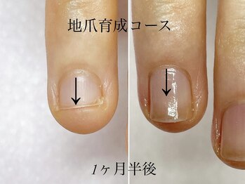 トゥインクリーネイルサロン(Twinkly Nail Salon)/【最強のネイルケア】1回お試し